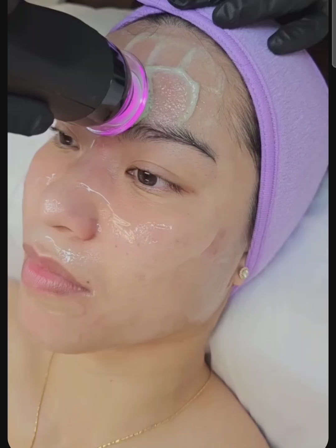 Oxygeneo 3 in 1 Facial