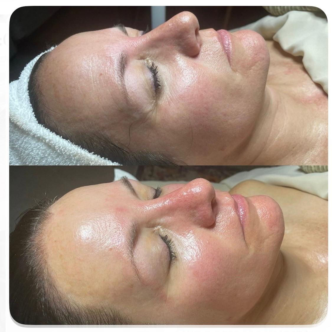 Signature Luxury Facial