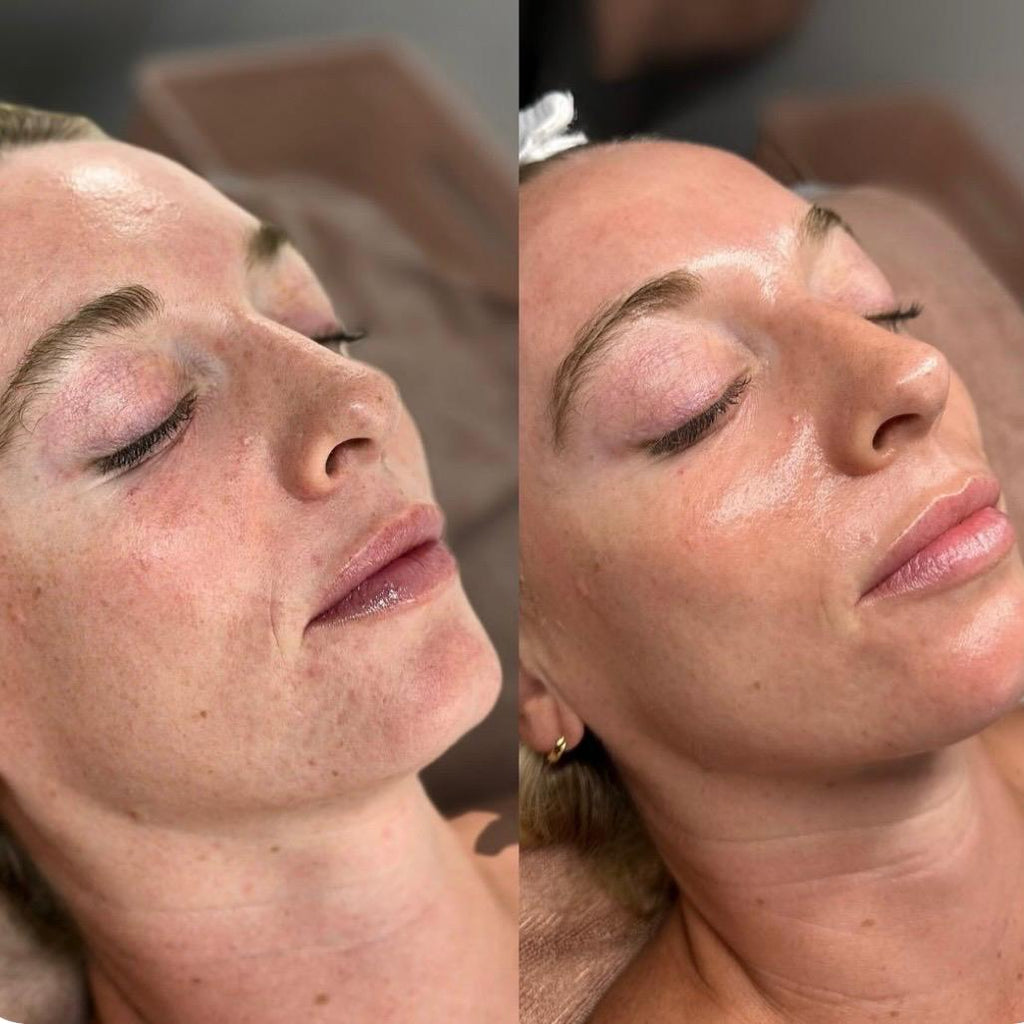 Aromatherapy Signature Facial