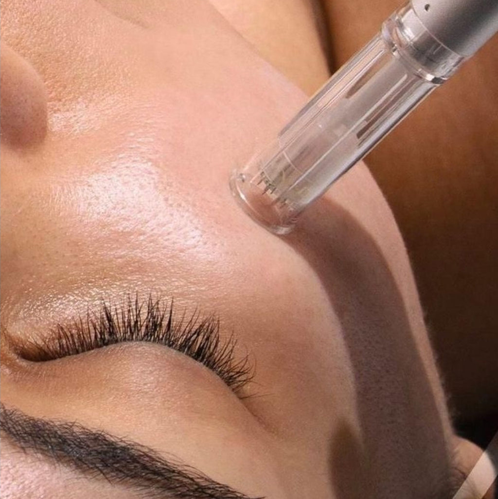 Micro Needling